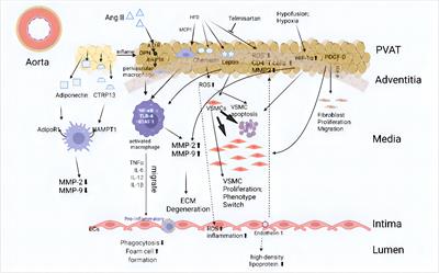 Obesity and the obesity paradox in abdominal aortic aneurysm